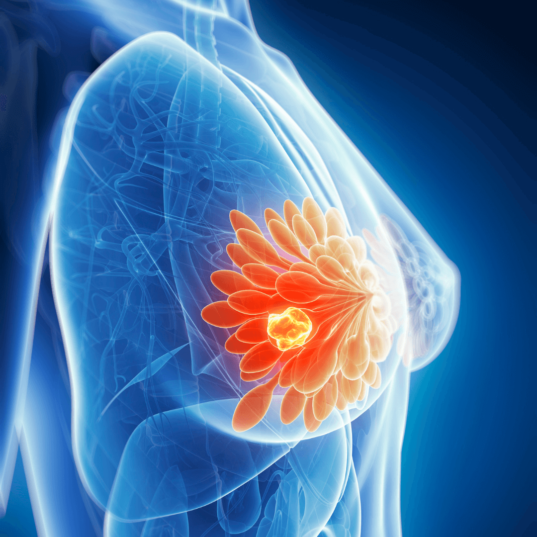 DNA Breast 360 Breast Cancer Screening & Reports